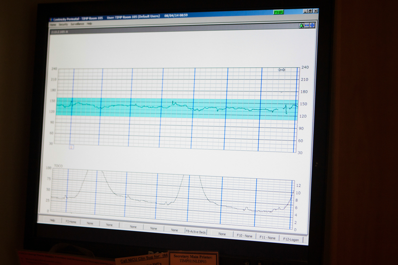Off-The-Chart contractions